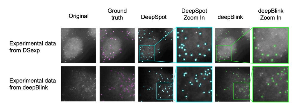 Deep Learning for automatic signal enhancement in biological imaging
